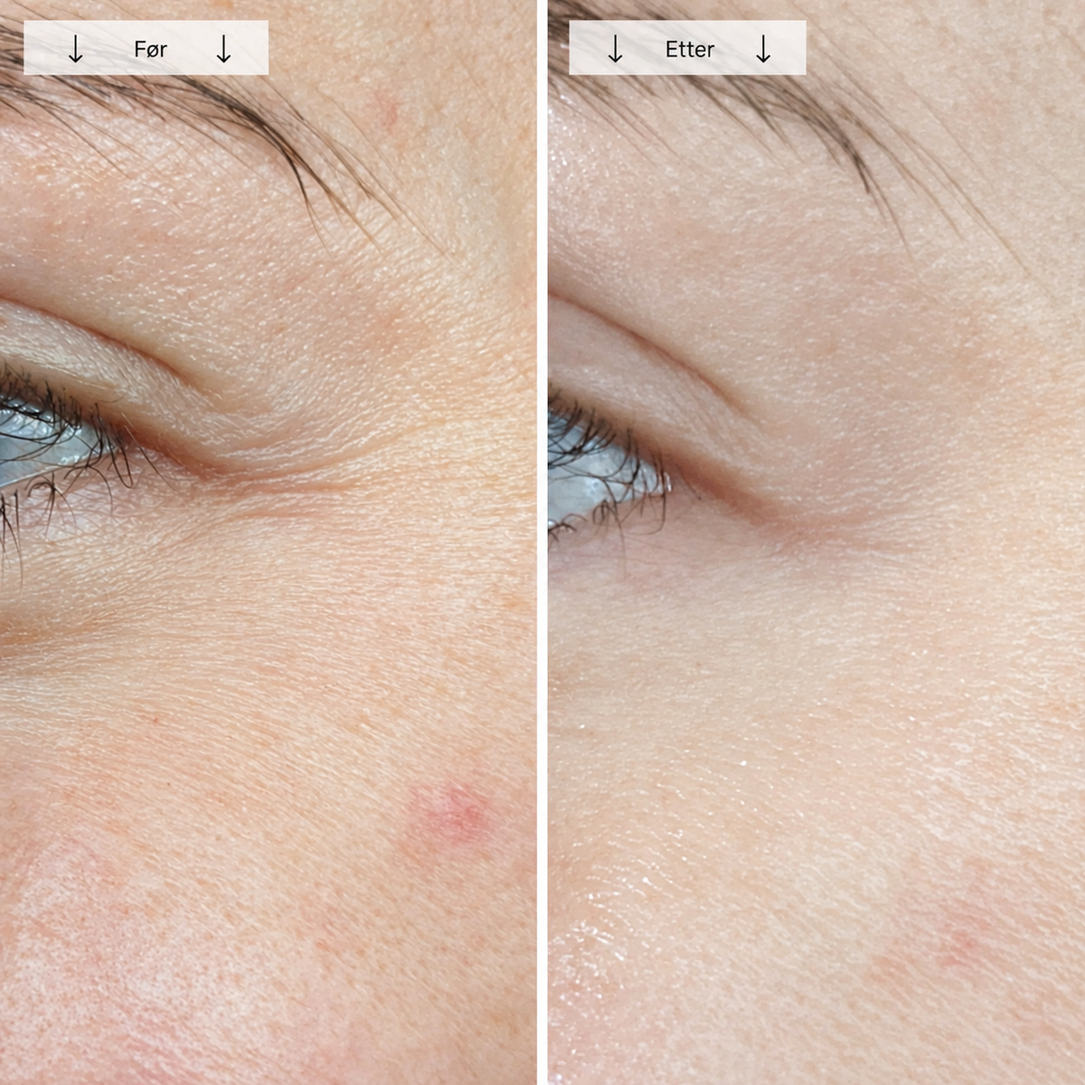 Beautyform® Nordglow Contour