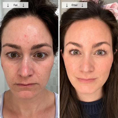 Beautyform® Nordglow Contour